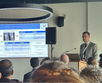 Rupert Wharton presents at British Society for Surgery of the Hand Meeting, Swansea