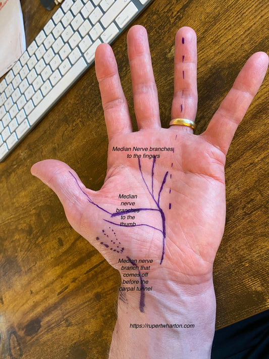 My carpal tunnel syndrome is bilateral, can I have both sides operated on at the same time?